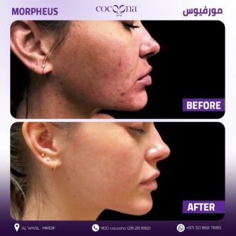 موفيوس - Morpheus