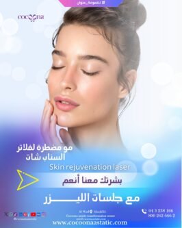 Say Goodbye to Filters, Hello to Smooth Skin!” – Skin Rejuvenation Laser – ليزر تجديد البشرة
